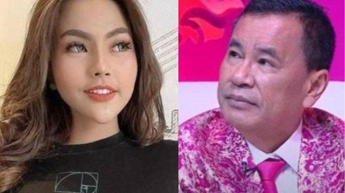 Usai Ngaku Hamil Anak Ridwan Kamil, Lisa Mariana Kejar-kejar Hotman Paris